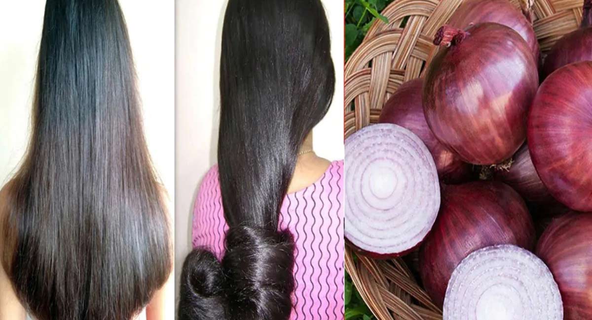 Is onion good for hair growth