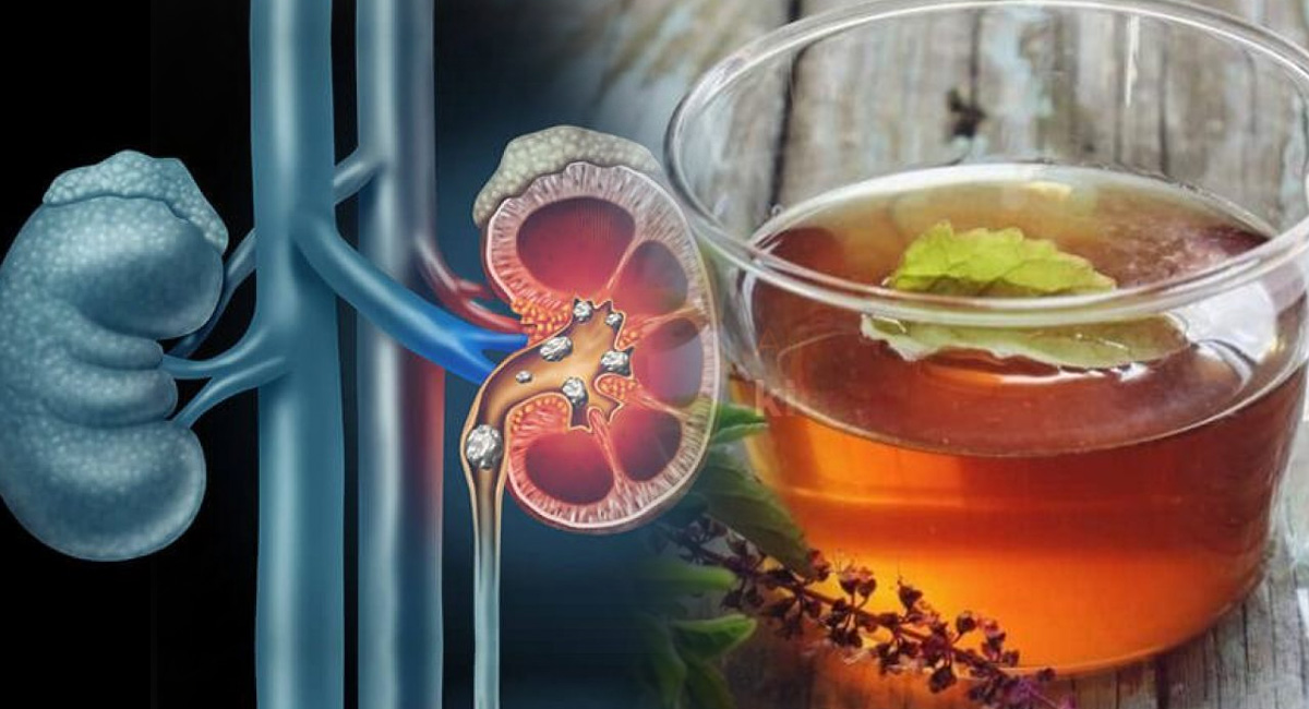 These Herbal Drink To Check Kidney Stones